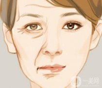 除皺的后遺癥有哪些？