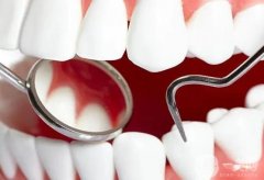 洗牙的時(shí)候可以刷醫(yī)?？▎?？