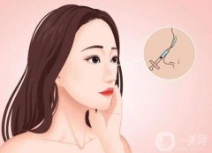 有哪些因素影響鼻翼內(nèi)切的價格？