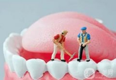 洗牙后什么時候可以吃東西？