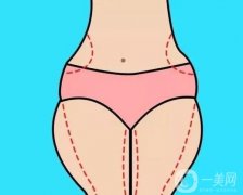 抽脂可以瘦多少？抽脂手術(shù)方法有哪些？