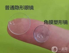 角膜塑形鏡有什么作用？