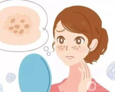 有哪些正確的祛斑方法？
