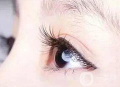 孕睫術(shù)后多久做美瞳線？孕睫術(shù)緩解眼睛腫脹的小竅門