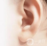 有哪些豐耳垂的方法？