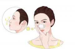 膨體假體隆鼻能保持多久?膨體隆鼻的后遺癥有哪些?