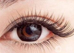 嫁接睫毛和種植睫毛哪個(gè)更好?嫁接睫毛需要多長時(shí)間?
