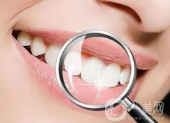 牙齒不好可以做冷光美白嗎?冷光美白牙齒能持續(xù)多久?