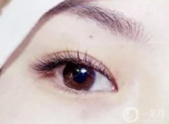 種植睫毛眼睛為什么會(huì)腫?眼睛腫了怎么辦?