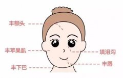 注射玻尿酸填充法令紋會(huì)不會(huì)紅腫？