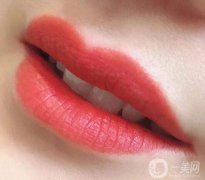 漂唇有什么好處?漂唇的注意事項(xiàng)?