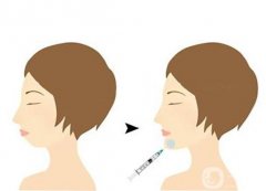 下巴注射玻尿酸注射有哪些注意事項(xiàng)呢？