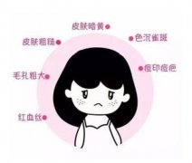 果酸換膚的步驟？如何護理