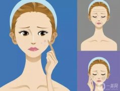 光子嫩膚的副作用有哪些?光子嫩膚后如何護理?