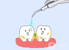 超聲波洗牙前的注意事項(xiàng)有哪些？