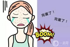 激光祛斑后好不吃哪些食物?