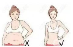 腹部吸脂有哪些誤區(qū)？