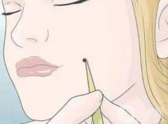 激光點(diǎn)痣后的小洞洞如何護(hù)理？
