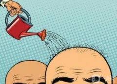 植發(fā)之后多少天可以洗頭呢？