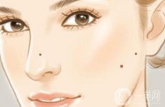 激光點(diǎn)痣的危害有哪些？