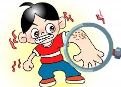 雞皮可以用激光去除嗎？