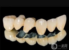 烤瓷牙貴嗎?怎么保養(yǎng)？