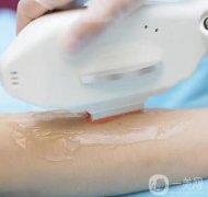 彩光脫毛有什么禁忌?皮膚黑的人適合彩光脫毛嗎?