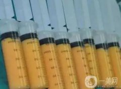 自體脂肪豐下巴后疼痛會維持幾天?自體脂肪豐下巴會有后遺癥嗎?