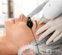 激光洗眉的原理和副作用是什么