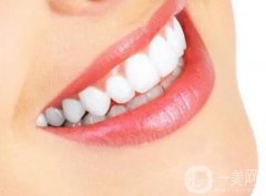 冷光美白牙齒之前需要注意什么?冷光美白牙齒之后應(yīng)該注意什么?