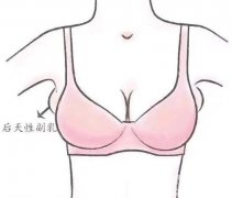 副乳切除術(shù)價格的影響因素有哪些？