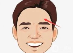 豐額頭的手術(shù)方法有哪些?