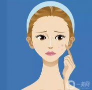 多久做一次光子嫩膚?