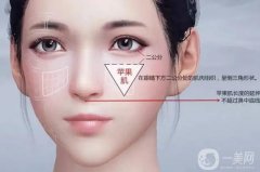 豐蘋果肌失敗怎么辦?