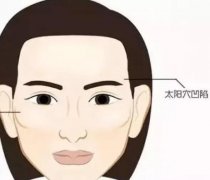 改變太陽穴凹陷有哪些方法？