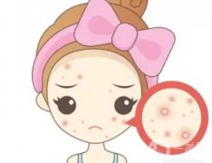 點(diǎn)陣激光去除痘印果怎么樣呢？