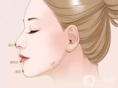 玻尿酸墊下巴怎么護(hù)理能夠？