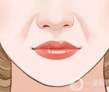 墊鼻基底能有改良法令紋嗎？