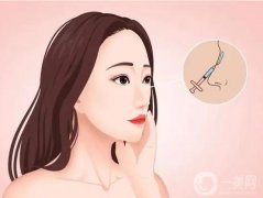 硅膠隆鼻好嗎？可以取出硅膠隆鼻嗎？