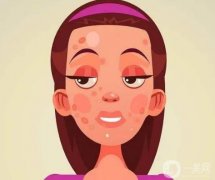 光子嫩膚是什么？做光子嫩膚的步驟？