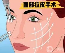 電波拉皮的副作用是什么?