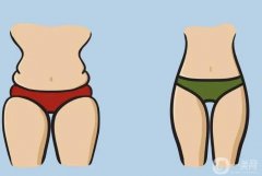 大腿抽脂需要穿多久塑身褲?