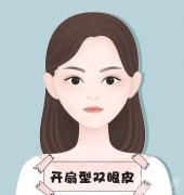 如何在切雙眼皮后快速消腫
