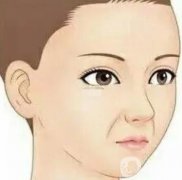 鼻基底填充需要多少錢，鼻基底填充恢復需要多長時間