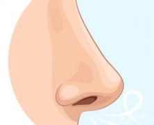 耳軟骨墊鼻尖取出后恢復期如何護理?