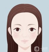 膠原蛋白填充淚溝有果嗎?