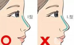 隆鼻會導(dǎo)致眼距縮短嗎？