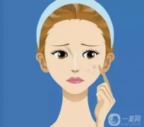 光子嫩膚可以去除雀斑、黃褐斑嗎？