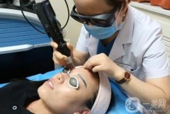 激光洗眉后紅色印記多久會(huì)消失？怎么護(hù)理？