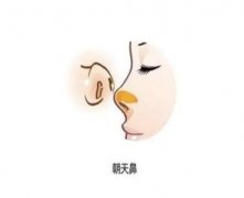 矯正朝天鼻存在風(fēng)險(xiǎn)嗎？矯正失敗時(shí)會(huì)怎么樣？